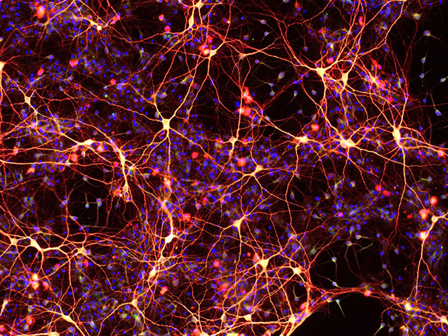 Neurons created from chemically induced neural stem cells. The cells were created from skin cells that were reprogrammed into neural stem cells using a cocktail of only nine chemicals. This is the first time cellular reprogramming has been accomplished without adding external genes to the cells. [Mingliang Zhang, Ph.D., Gladstone Institutes]