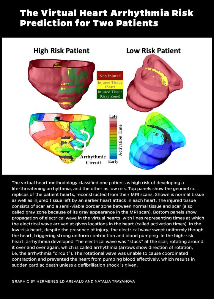 Examples of how the 3-D computer model would classify one patient at high risk for heart arrhythmia and another at low risk. [Johns Hopkins University]