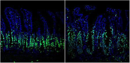 Immunofluorescent staining of intestinal epithelium tissue shows cell growth (green). In a normal mouse model (left), cell growth is controlled, but in a mouse model with the ERK1/2 pathway blocked (right) increased cell proliferation and loss of organization occurred. [UC San Diego Health]