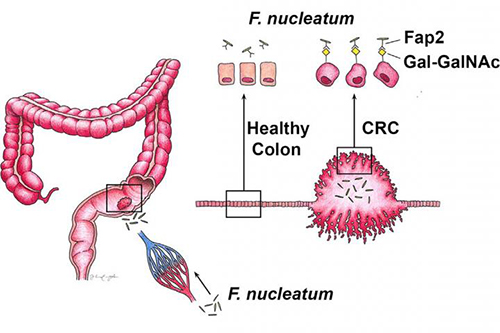 This schematic depicts the findings of Abed et al., who identify a host polysaccharide, Gal-GalNAc, and fusobacterial lectin (Fap2) that explicate fusobacteria abundance in colorectal cancer (CRC). Targeting Fap2 or host Gal-GalNAc may provide a means to reduce <i>F. nucleatum</i> potentiation of CRC. [Abed et al./Cell Host & Microbe 2016]” /><br />
<span class=