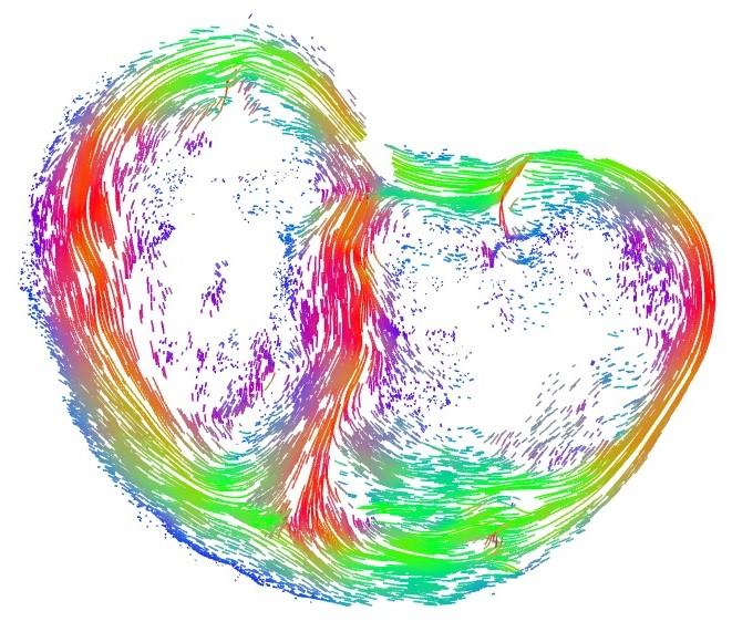 Image of the fetal heart at the end of the 4 days when cardiac tissue is organized into the helix shape of the heart.[Eleftheria Pervolaraki/University of Leeds]