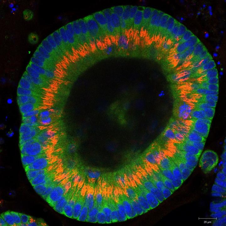 Colon cancer cells organoids [Dr. Joseph Regan/Charité - Universitätsmedizin Berlin]