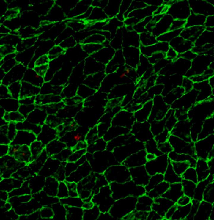 The image shows blood-patrolling monocytes (red) adhering to inflamed endothelium (green) in the inner curvature of the aortic arch of a mouse with incipient atherosclerosis. [CNIC]