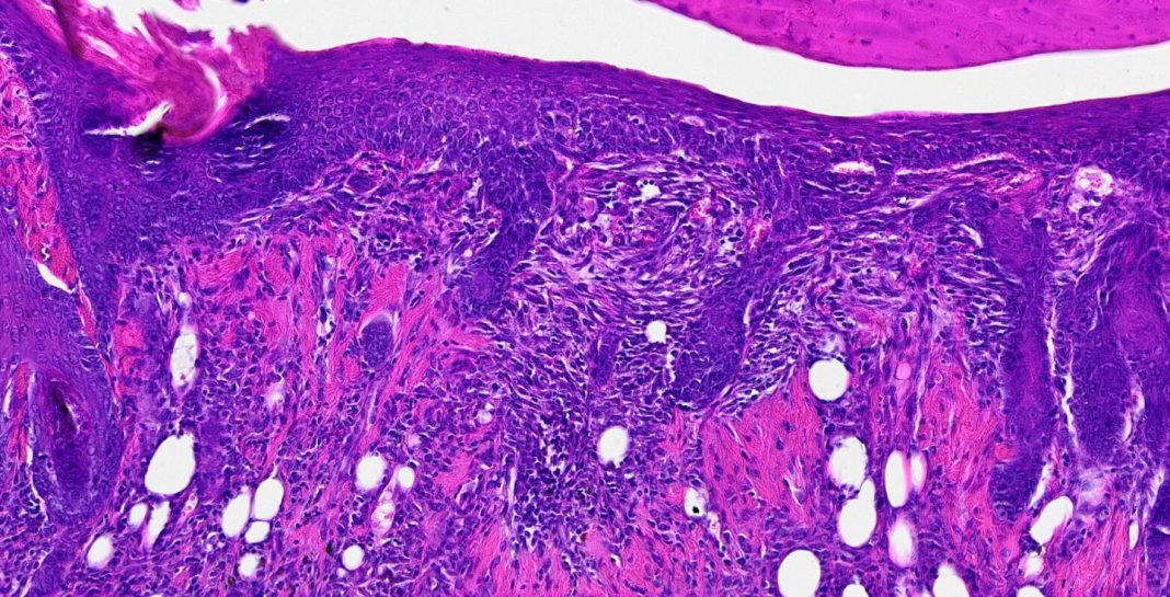 Tissue section 14 days postwounding reveals the presence of hair follicles regenerating at the center of the wound. Regrowing hair follicles is one of the biggest challenges in the field of wound healing. [Disease Biophysics Group/Harvard University]