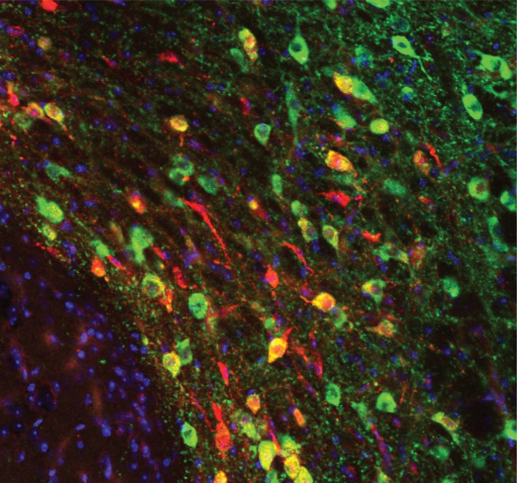Autism Social Interaction Difficulties Caused By Poor Synapse