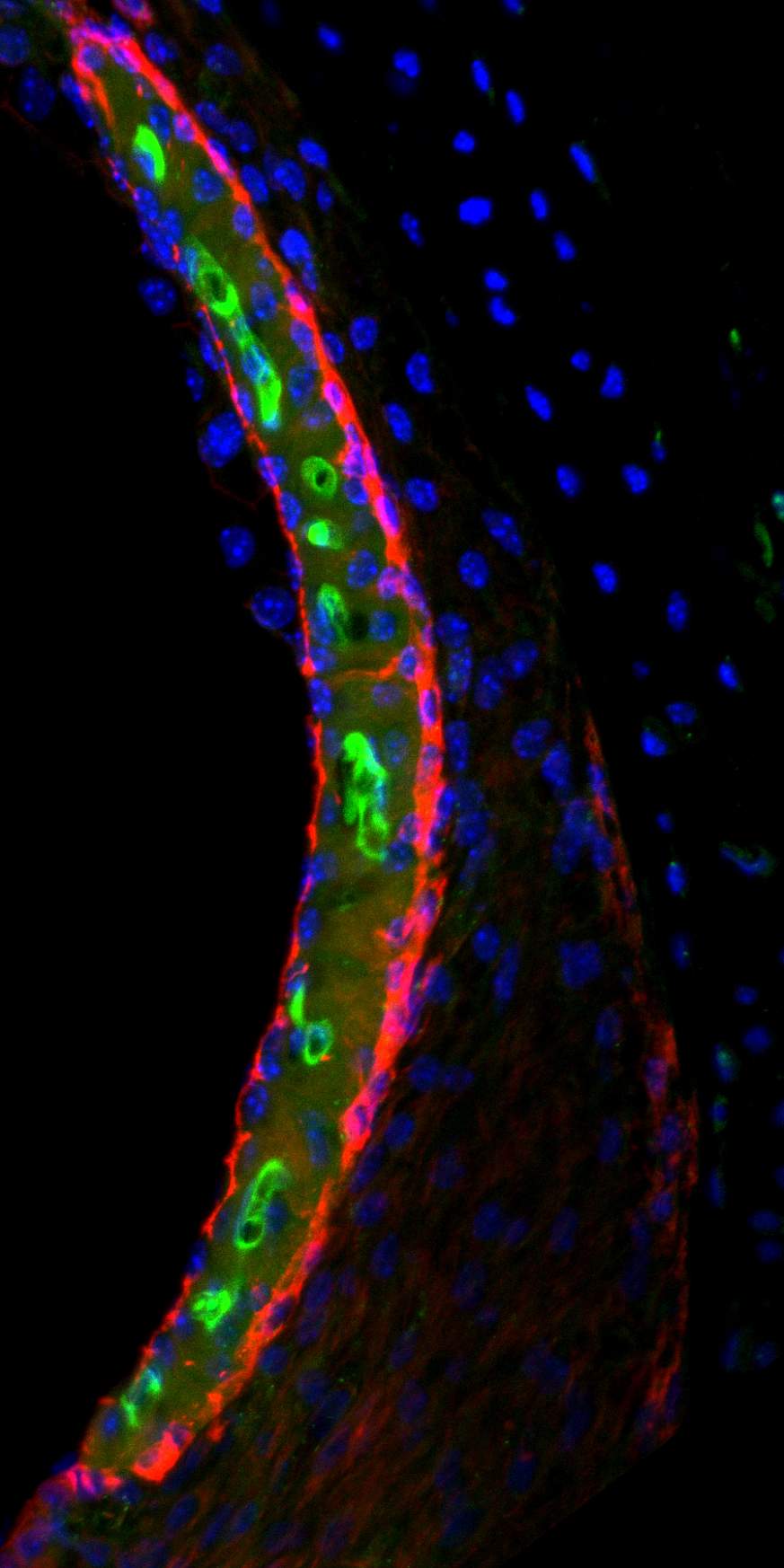Cisplatin (appearing in green) in the stria vascularis of a mouse inner ear. [NIH]