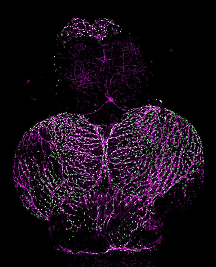 Image of an adult zebrafish brain showing fluorescent granular perithelial cells (green) atop blood vessels (magenta). [NIH]