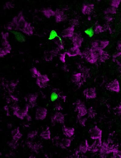 Newly identified, rare pulmonary ionocytes (green) dot the landscape of ciliated cells (magenta) of the mouse lung airway lining. [Montoro et al./Nature 2018]