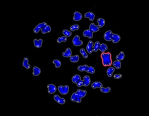 This image shows chromosome abnormalities in reprogrammed cells in which SIRT1 protein has been removed (in red). [Centro Nacional de Investigaciones Oncologicas]