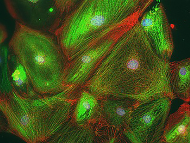 Heart cells created from stem cells manipulated using CRISPRi. [Mo Mandegar