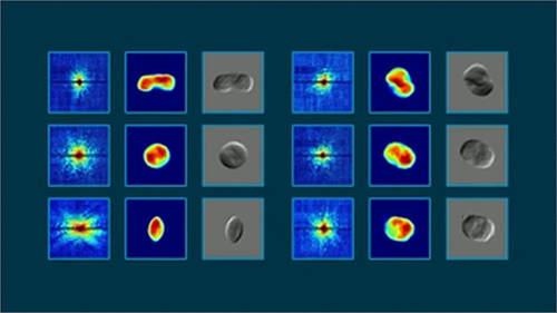 X-ray portraits of living cyanobacteria using SLAC's Linac Coherent Light Source. Diffraction pattern (left)