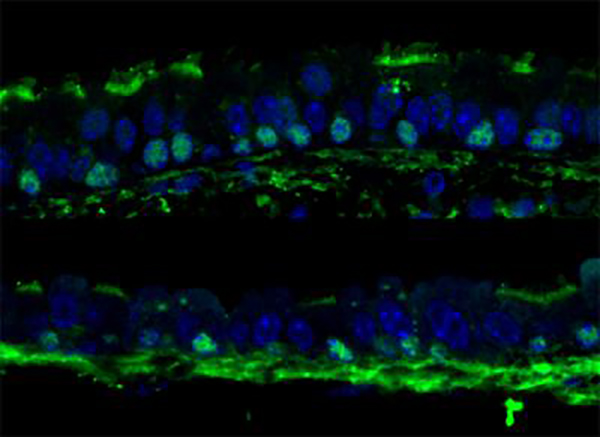 (Top) Tracheal epithelium after one round of regeneration. (Bottom) Tracheal epithelium after three rounds of regeneration. The stem cells are green (marked with a Trp63 staining)