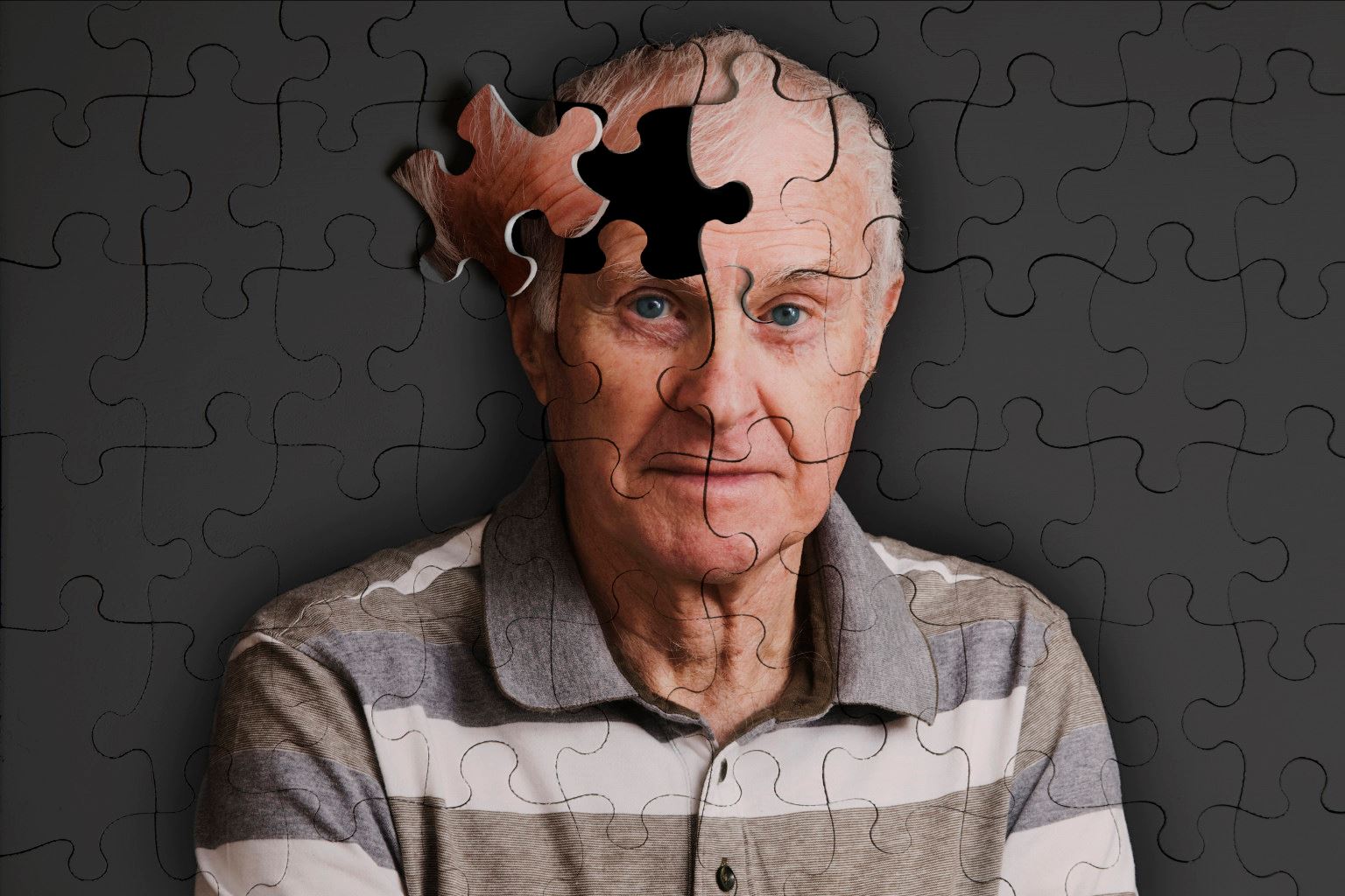 people with alzheimer