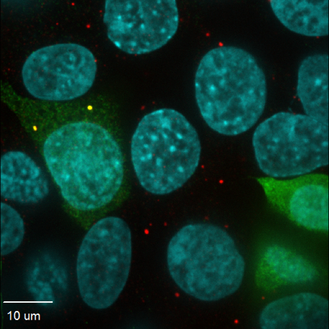 Human kidney cells stained with a P-body marker (red) and NoBody microprotein (green). Yellow dots are where P-bodies and NoBody interact. Cell nuclei are shown in blue. [MIT/Yale]