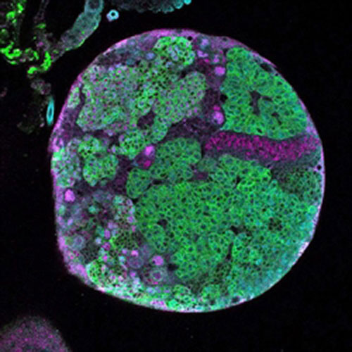 With the enzyme Eyeless knocked out, cells over-proliferate (shown in green) in a fruit fly's larval brain during reactivated Notch signaling. [University of Oregon]