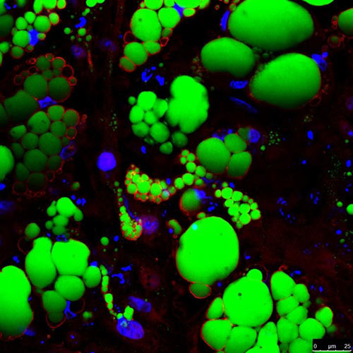 This image shows human pluripotent stem cell-derived fat cells. [Tim Ahfeldt/Harvard University]