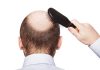 Potential Therapeutic Treatment for Androgenetic Alopecia
