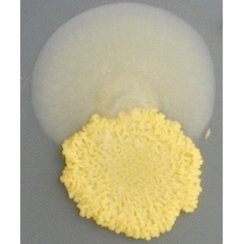 Drug resistant “epimutants” emerging from a drug sensitive yeast colony. [Soo Chan Lee]