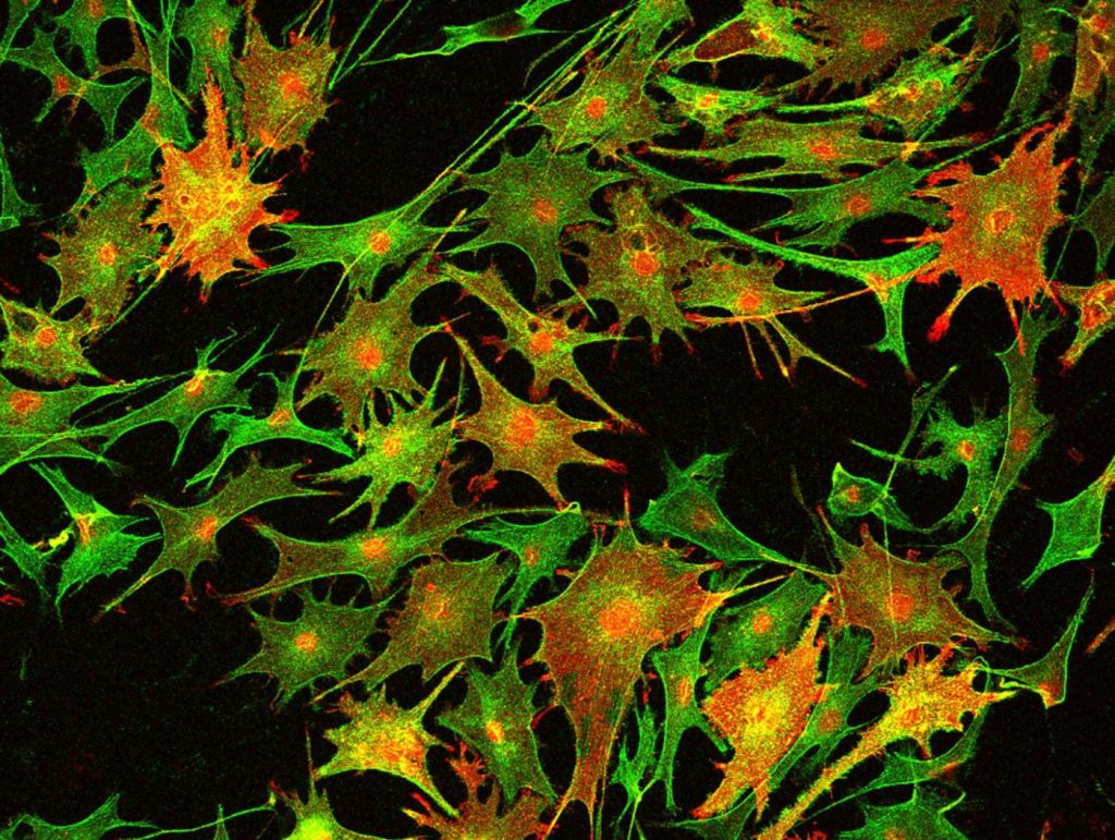 how inhibiting an enzyme called HDAC3 in mice increases the expansion of Schwann cells (green)