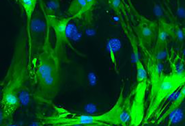 These cardiomyocytes (green with blue nuclei) had been fibroblasts before Frank Conlon's UNC lab reprogrammed them. [Conlon Lab/UNC-Chapel Hill]