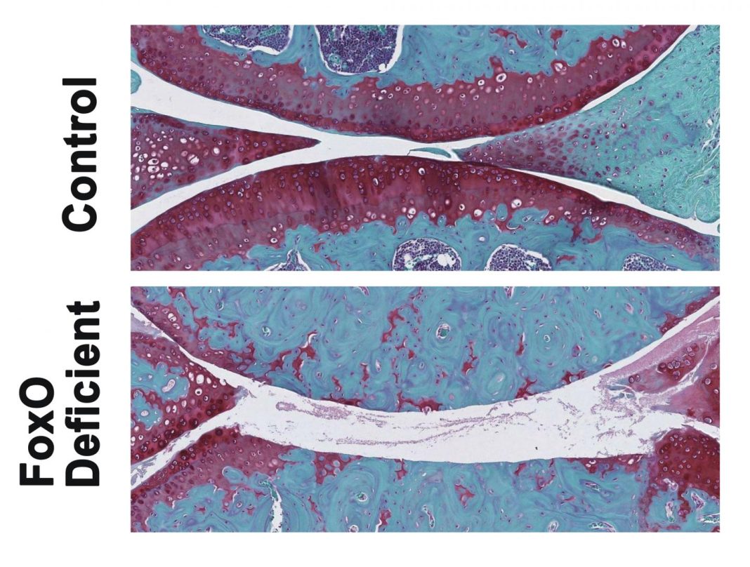 These are images of knee joints from control and FoxO-deficient mice. The areas in red are joint cartilage that is destroyed in FoxO-deficient mice after treadmill running. [Lotz Lab/The Scripps Research Institute]