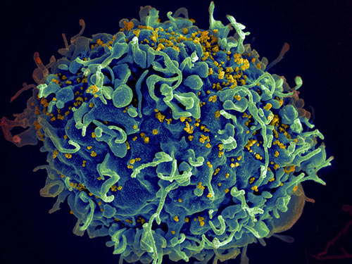 Scanning electron micrograph of HIV particles infecting a human T cell. By binding to two unchanging sites on the surface of HIV