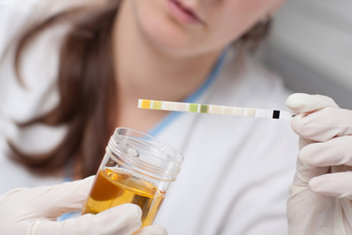 MIT Team Develops Urine Test for Cancer