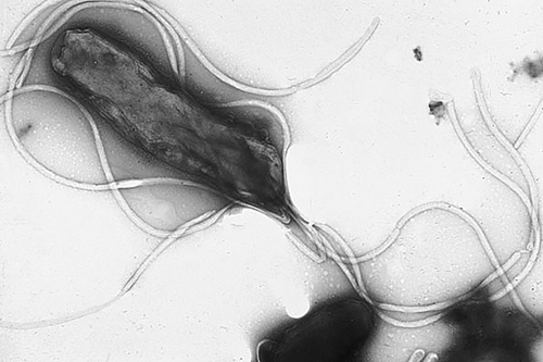 Electron micrograph of the stomach bacteria <i>Helicobactor pylori</i>. [Yutaka Tsutsumi