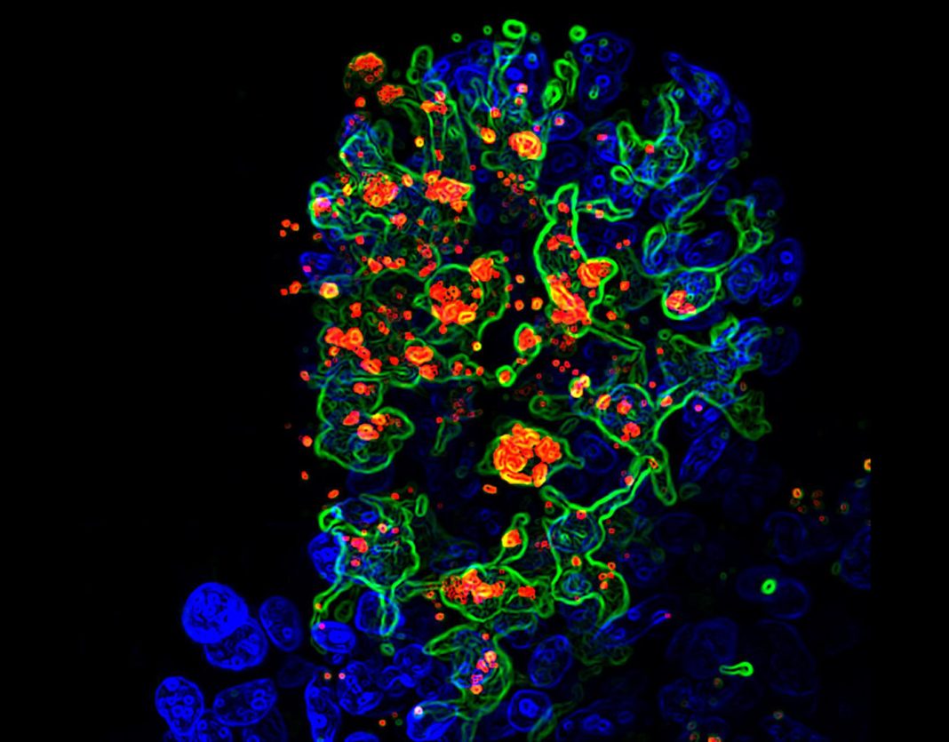 Opportunistic fungus Candida albicans (red) engulfed by CX3CR1+ phagocytes (green) in the gut villi (blue). [Iliyan Iliev and Irina Leonardi/Weill Cornell Medicine]