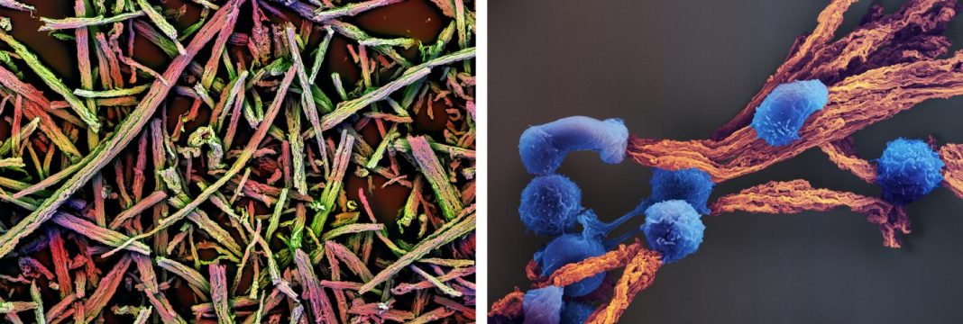 The left image shows a scanning electron micrograph (SEM) of a basic scaffold made of many tiny mesoporous silica rods (MSRs) before they are coated with a thin supported lipid bilayer (SLB) with the incorporated T cell-stimulating cues. In the right SEM image