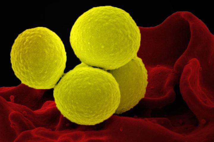 Detailed Molecular Signature Accurately Predicts Death from S. aureus Bacteremia