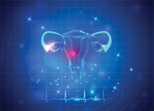 Lack of Microbial Diversity Linked to Polycystic Ovary Syndrome