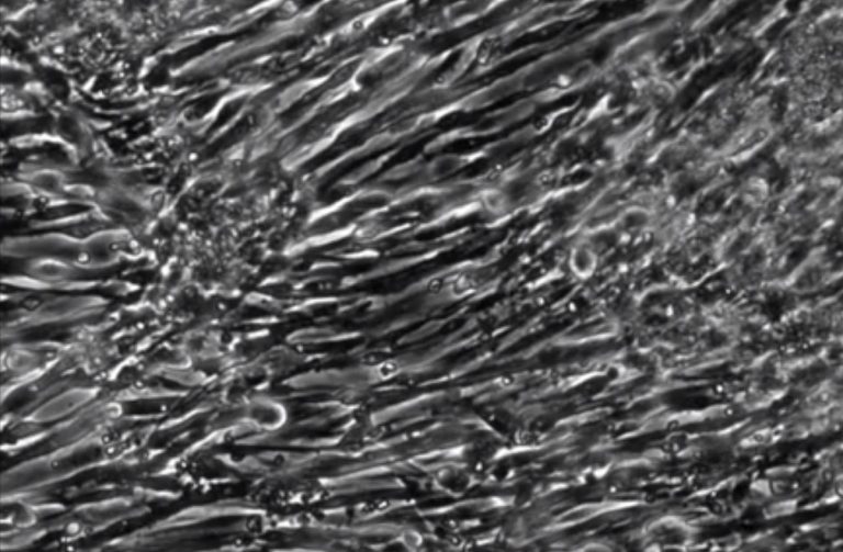 Functioning Human Skeletal Muscle Grown from Induced Pluripotent Stem Cells