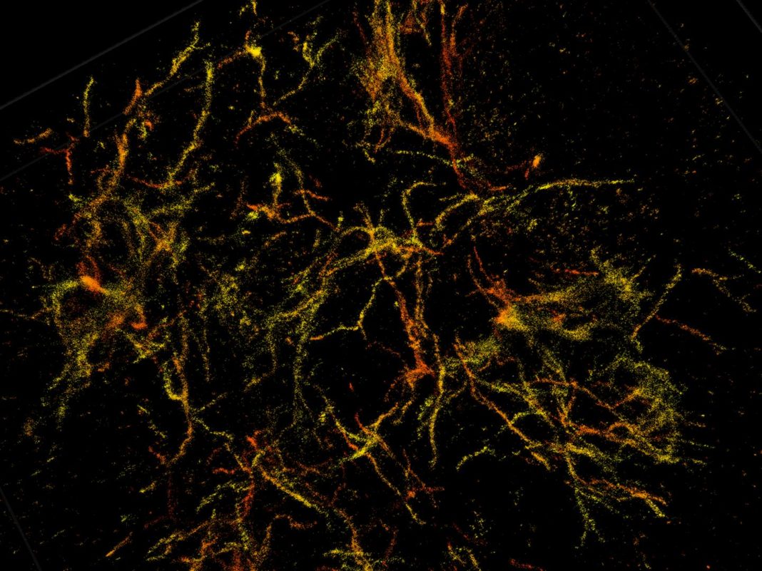 Purdue researchers have taken 3D single molecule super-resolution images of the amyloid plaques associated with Alzheimer's disease in 30-micron thick sections of the mouse's frontal cortex. [Purdue University image/Fenil Patel]