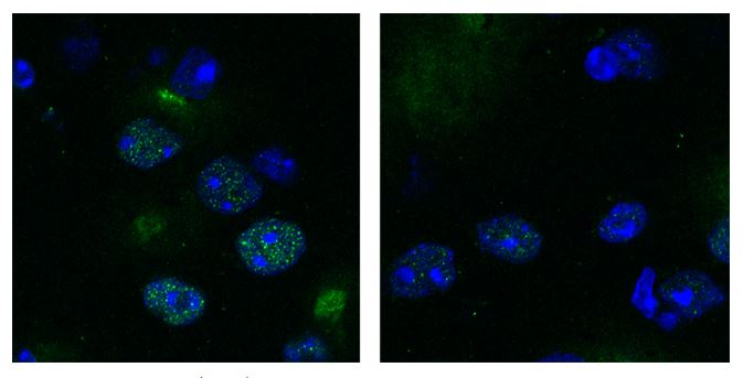 A drug development screen capable of identifying selective phosphatase inhibitors has been used to find a drug candidate that can target a phosphatase implicated in Huntington’s disease. Left: Huntingtin protein (green) accumulated in the cells from the brains of mice given a placebo. Right: Reduced buildup of huntingtin protein in cells from mice treated with the drug candidate