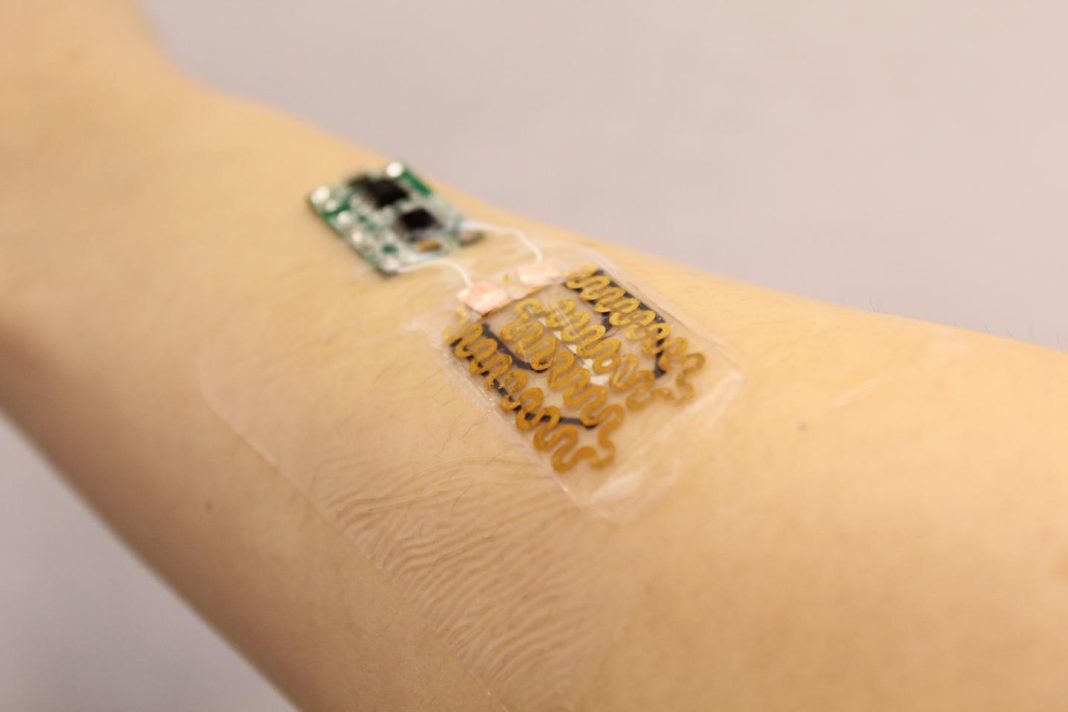 A smart bandage placed on an arm. Temperature and pH sensors in the bandage (right) are read by a microprocessor (left)