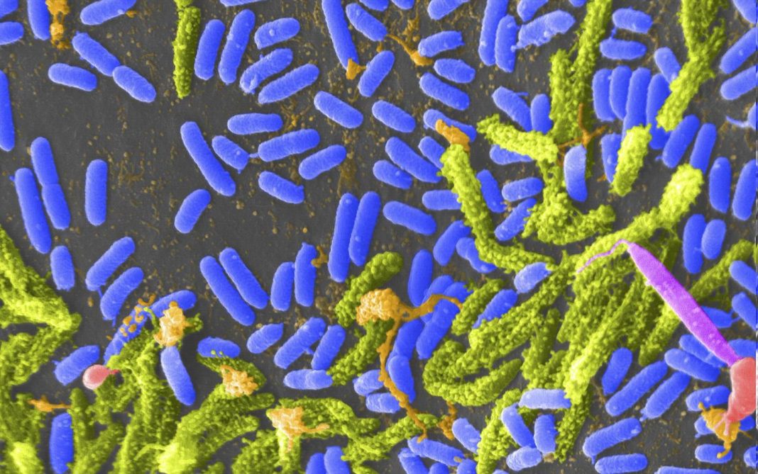 Some species of <i>Vibrio</i> bacteria (blue) can cause cholera in humans. A version of <i>Vibrio cholerae</i> designed to be harmless may one day protect people against the dangerous form of the bacteria. [Tina Carvalho/University of Hawaii at Manoa/CC BY 2.0]