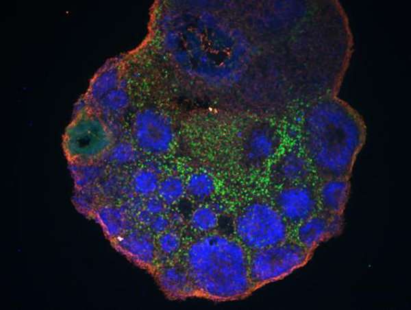 Studying lab-grown cerebral organoids (one derived from chimpanzee cells