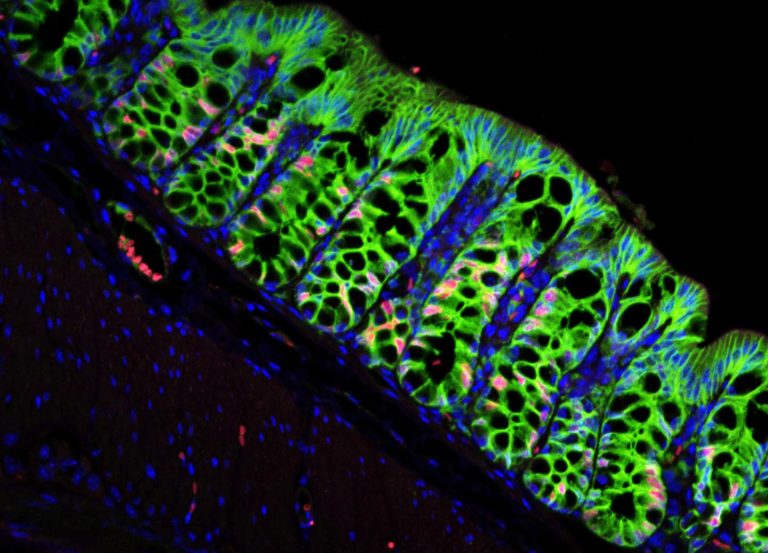 Colon Stem Cells Rely on This Repair Signal, but It Can Go Awry