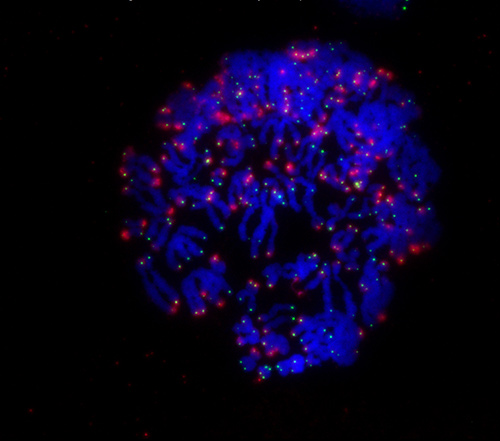 During mitosis, a cell’s chromosomes (blue) rapidly divide. When telomeres (green) are no longer protected by the protein TRF2, the cell receives a signal to undergo cell death (red). [Salk Institute]