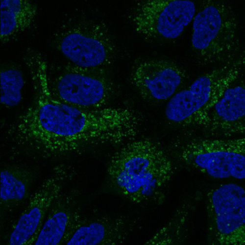 Cell recycling (shown in green) is elevated in lung cancer cells treated with an established cancer drug. Recycling is suppressed upon co-treatment with a newly discovered enzyme inhibitor. [Salk Institute]