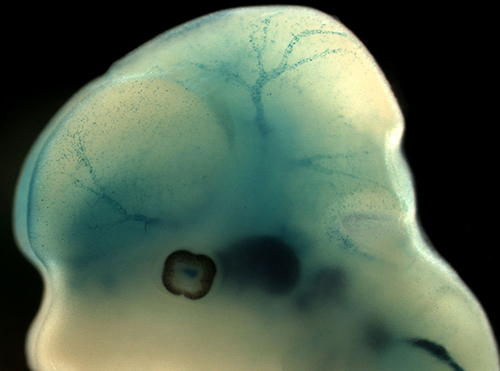 Foxf2 protein is needed for brain pericyte differentiation and maintenance of the blood-brain barrier. Brain pericytes in this mouse embryo are visible as blue dots along blood vessels. [University of Gothenburg]