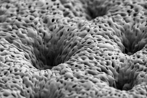 Scanning electron micrograph of a porous