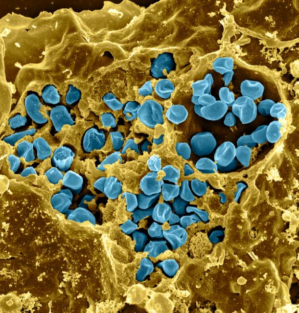 Halting Ribosomal Rescue Key to Thwarting Virulent Bacteria