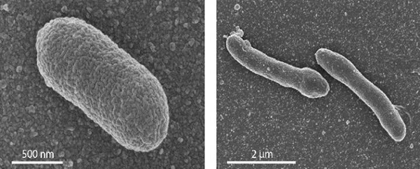 (Left) Electron micrograph of a normal <i>Escherichia coli</i> cell. (Right) An engineered cell with a mixed membrane