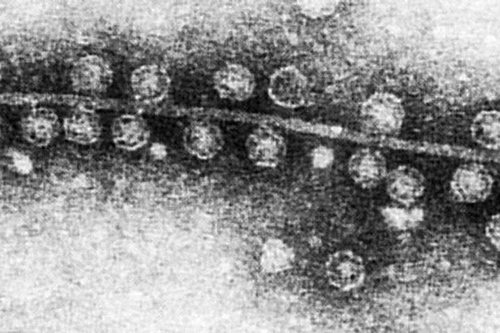 Micrograph image of RNA bacteriophages attached to part of the bacterium <i>E. coli</i>. A new study at Washington University School of Medicine in St. Louis suggests that bacteriophages made of RNA, a close chemical cousin of DNA, likely play a much larger role in shaping the bacterial makeup of worldwide habitats than previously recognized. [Graham Beards/Wikimedia]” /><br />
<span class=