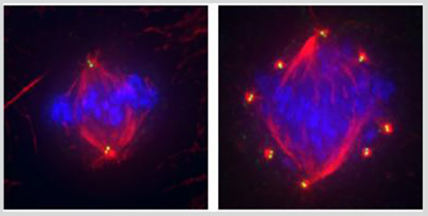Healthy cells (left image) display four centrioles