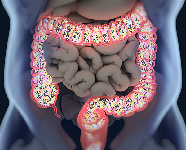 Microbiome’s Missing Bacteria Linked with Ulcerative Colitis