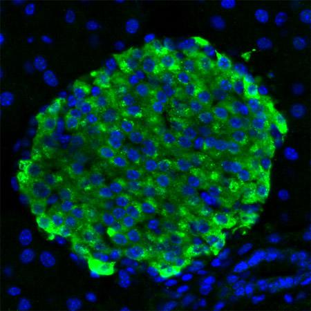 Researchers at UC San Diego School of Medicine have identified pathways that regulate pancreatic ß cell (pictured in green) growth. These cells help maintain normal blood glucose levels by producing the hormone insulin. [UCSD Health]