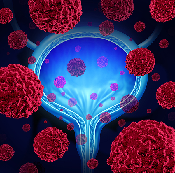 Ferring Gains Option to FKD’s Phase III Bladder Cancer Gene Therapy Candidate
